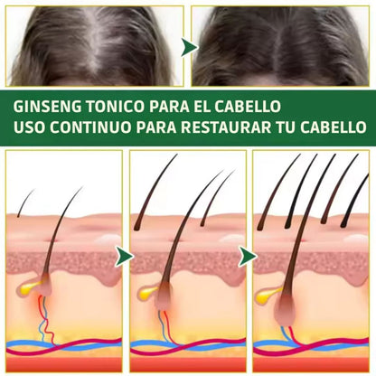 OUHOE CapilFort - TONICO PARA LA CAIDA DEL CABELLO DE 100 ML